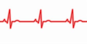 Image result for 12 Lead EKG Clip Art