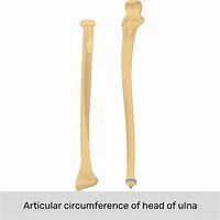 Image result for Radius Bone Unlabeled