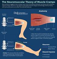 Image result for Front Thigh Muscle Cramps