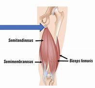 Image result for Tendinopathy Hamstring Knee