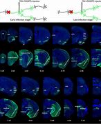 Image result for Brain Sorting Input