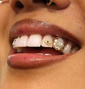 Image result for Dental Jewelry Teeth