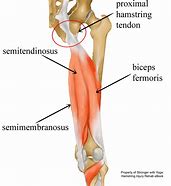 Image result for Tendinopathy Hamstring Knee