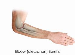 Image result for Elbow