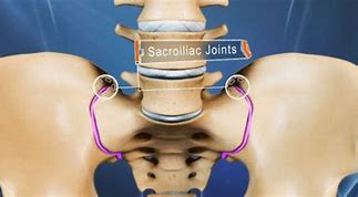 Image result for Lower Back Pain Sacroiliac Joint