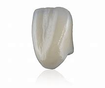 Image result for Zirconia Crown Tooth