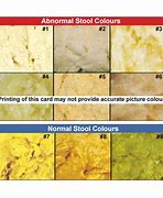 Image result for Nursing Bowel Movement Chart