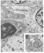 Image result for Langerhans Cells Function