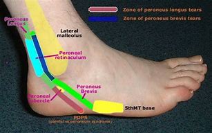 Image result for Tendons in Ankle