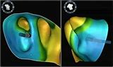 Image result for Heart Blood Flow Mnemonic