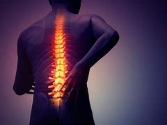 Image result for Subluxation Complex