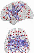 Image result for Neural Network in Human Brain Image