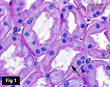 Image result for Renal Brush Border