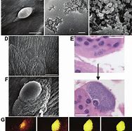 Image result for Intracellular Bacterial Infection