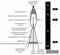 Image result for Chatlier Apparatus