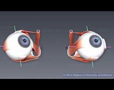 Image result for Conjugate Eye Movement