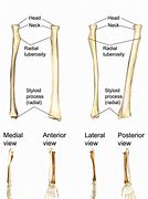 Image result for Left Radius