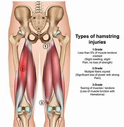 Image result for Hamstring Muscle Pain