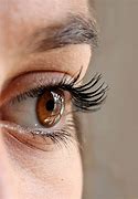 Image result for Alopecia Eyebrows