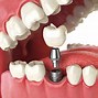 Image result for Dental 3DIcon