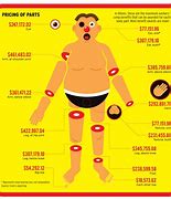 Image result for Workers-Compensation Body Parts Chart