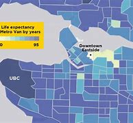 Image result for Parkinson's Life Expectancy Chart