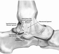 Image result for Deltoid Ligament Ankle