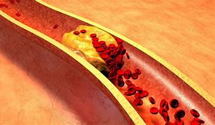 Image result for Blood Lipids