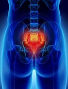 Image result for Lower Back Pain Sacroiliac Joint