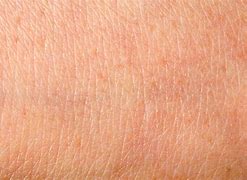 Image result for Real Alive Human Body Skin