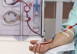 Image result for How Effective Is Dialysis