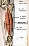 Image result for Hamstring Muscle Pain