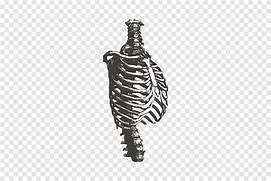 Image result for Flat Rib Cage in Infants