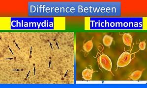 Image result for Chlamydia Em