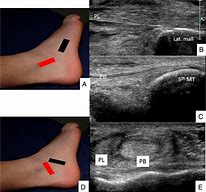 Image result for Tendons in Ankle