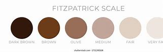 Image result for Human Skin Color Types