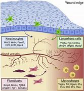 Image result for Island Og Langerhans Cells