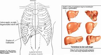 Image result for Rib Cage Associated to Liver