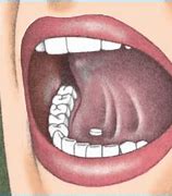 Image result for Sublingual Administration