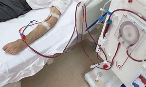 Image result for How Does Dialysis Work