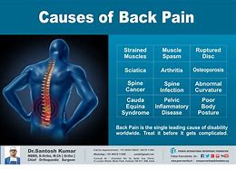 Image result for Lower Back Muscle Spasms Treatment