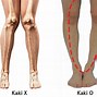 Image result for Rontgen Tulang Kaki