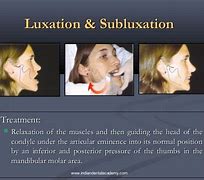 Image result for Subluxation X-ray