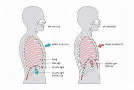 Image result for Flat Rib Cage in Infants