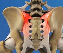 Image result for Normal Sacroiliac Joint X-ray