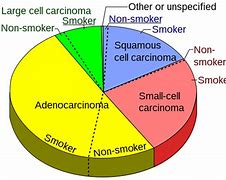 Image result for Lung Cancer Life Expectancy Chart