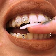 Image result for Tyla Teeth Jewelry