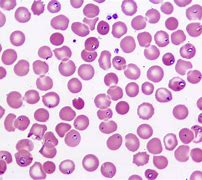 Image result for Intracellular Parasite