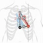 Image result for 12 Lead EKG Clip Art