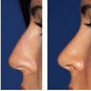 Image result for Pretty Nose Shapes